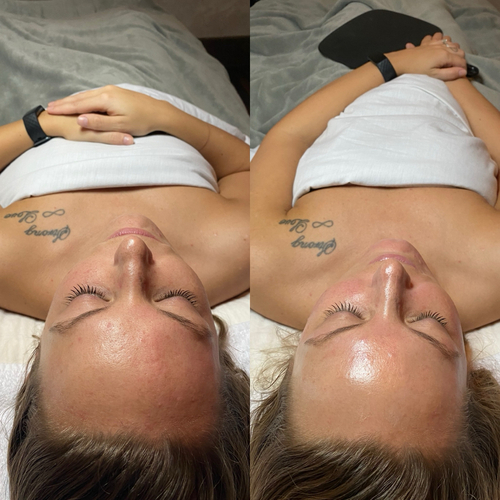 Custom Facial before and after at Nika Alviri Skin Studio, Nashville