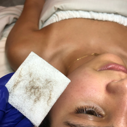 Dermaplane Facial before and after at Nika Alviri Skin Studio, Nashville