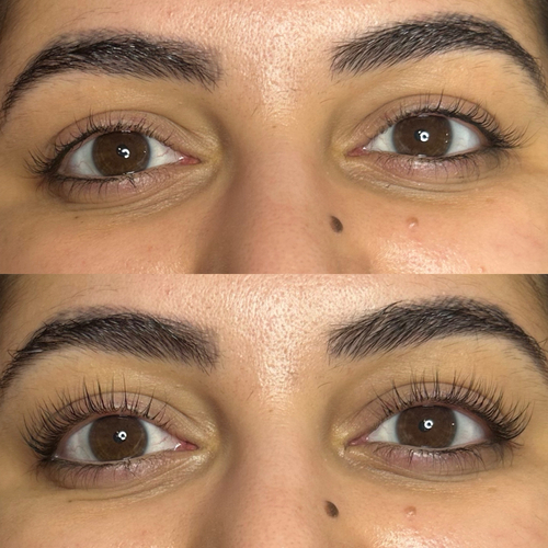 Treatment at Nika Alviri Skin Studio, a private skin studio in Bellevue, Nashville