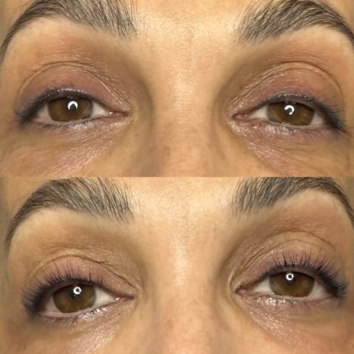 Treatment at Nika Alviri Skin Studio, a private skin studio in Bellevue, Nashville